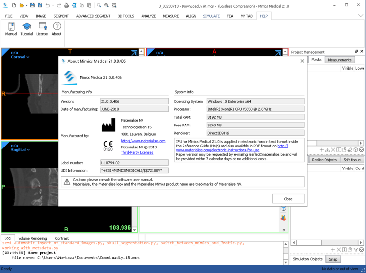 Materialise Mimics Innovation Suite 21.0 x64 / 3-matic 18.0.0.1645