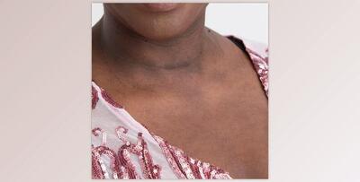 The Portrait Masters – The Retouching Series: Blotchy Skin