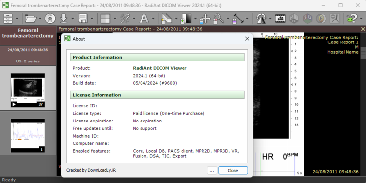 RadiAnt DICOM Viewer 2025.1