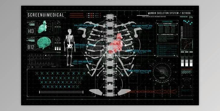 HUD700 Screen MEDICAL3 (Videohive 46324500) - AE Project