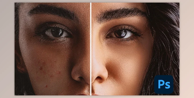 Professional Portrait Editing: High-End Skin Retouching & Teeth Whitening in Adobe Photoshop